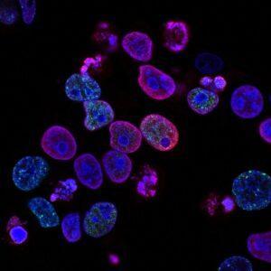 purple cells